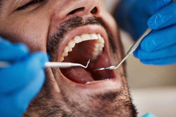 Best Cracked Tooth Emergency Dentist  in West Jefferson, NC